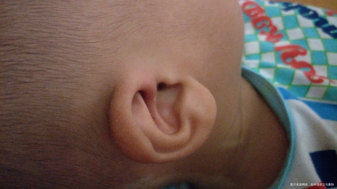 姐妹们,我儿子不知道怎么耳朵红了几天,