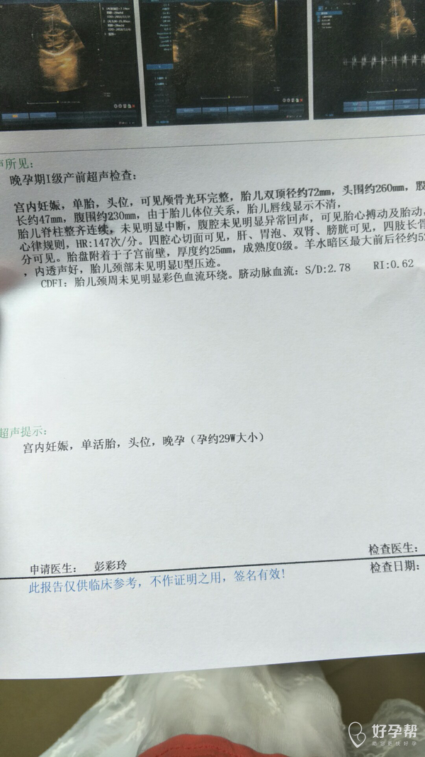 求求医生帮看看彩超结果怀孕二十七周