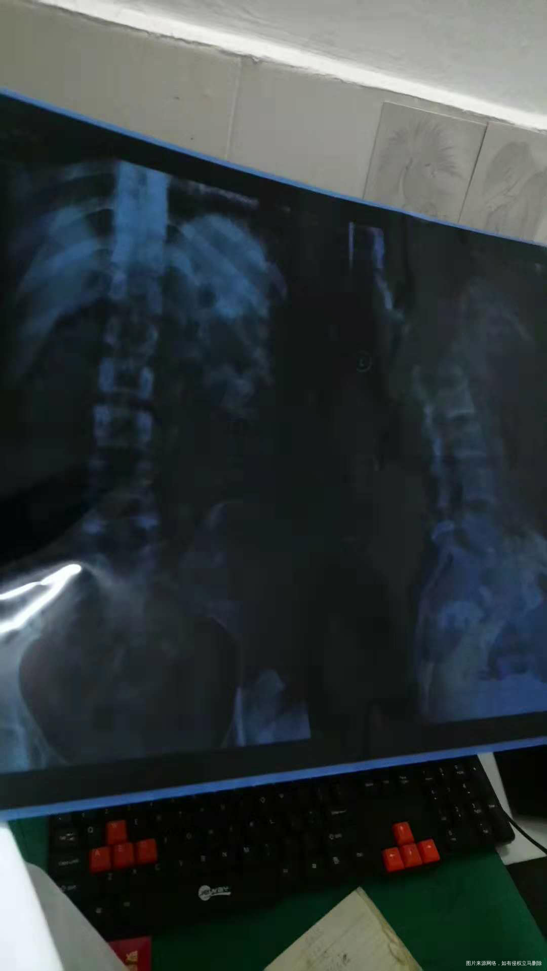 急急急急急急急急急,急急急