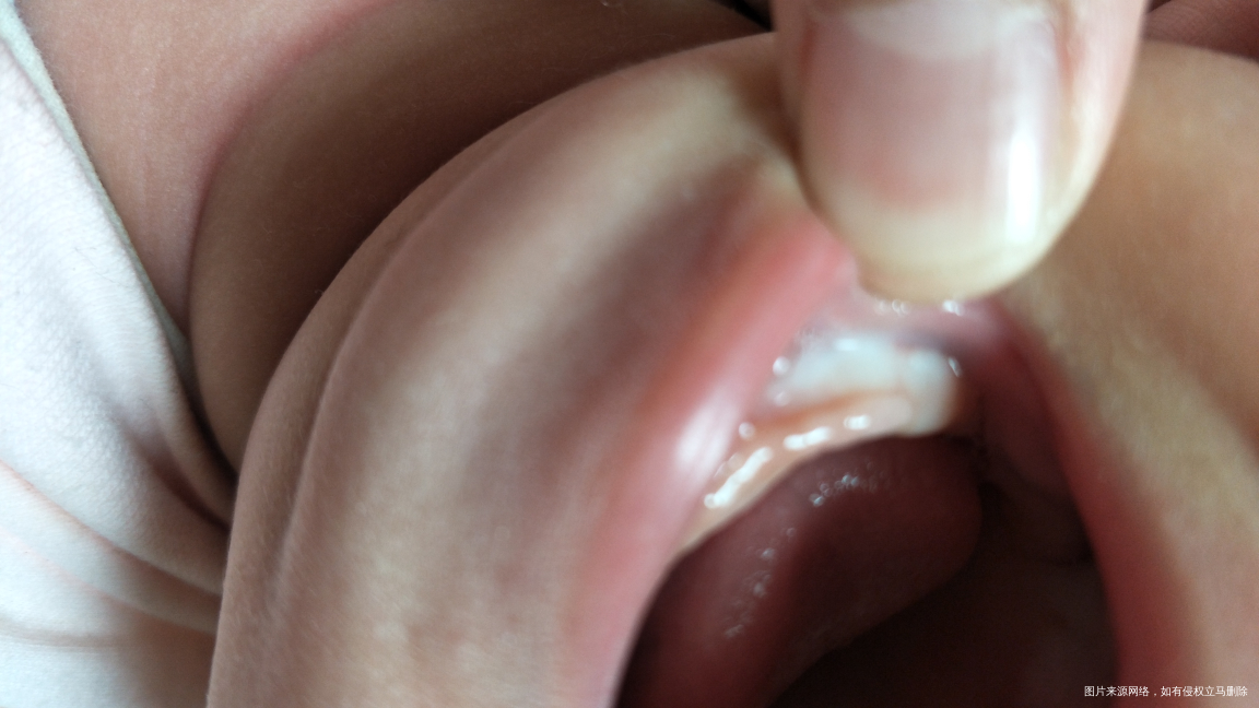 求姐妹们看看。这是不是马牙。还是正常的