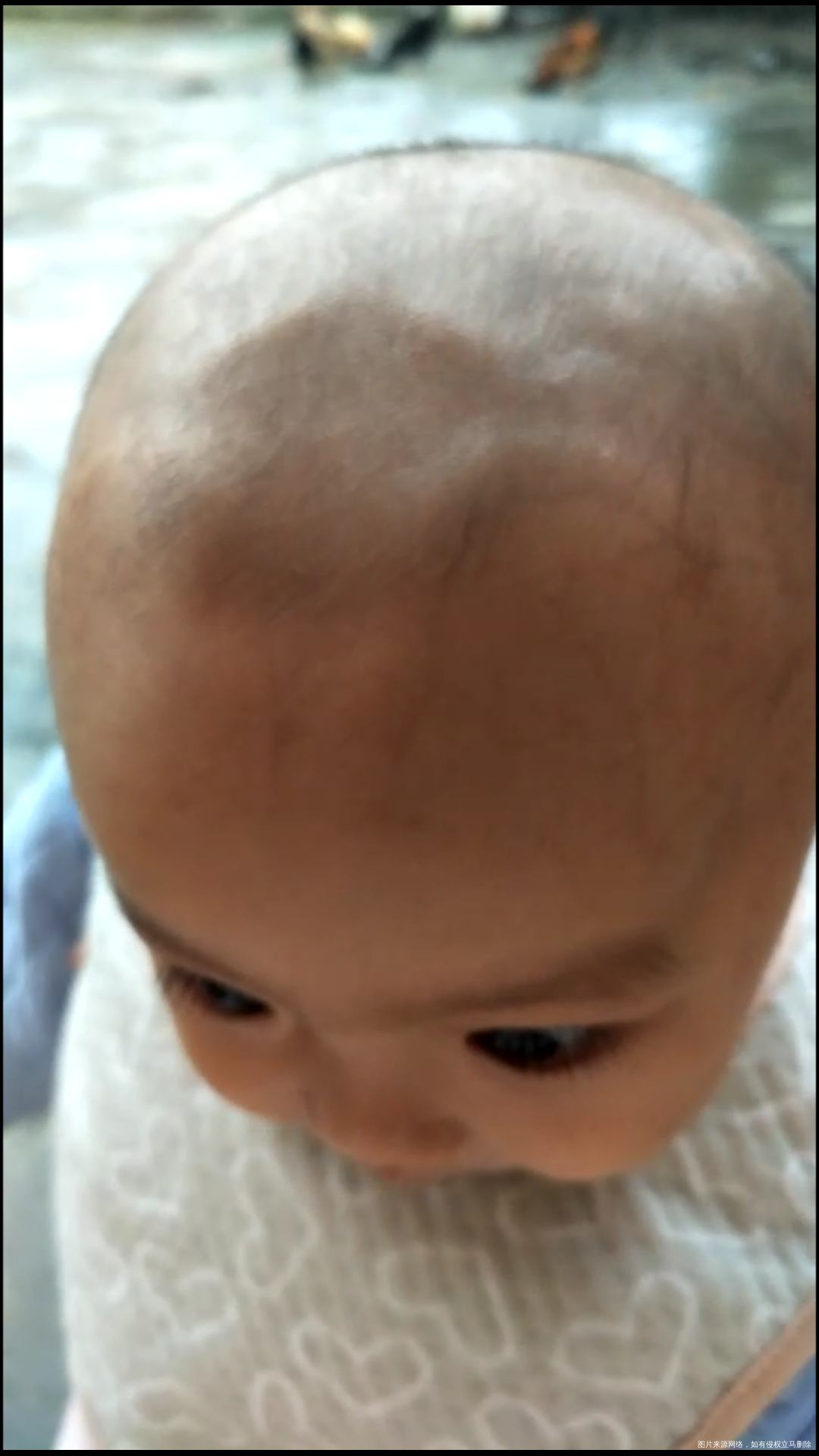 宝宝脑囱很宽,怎么回事