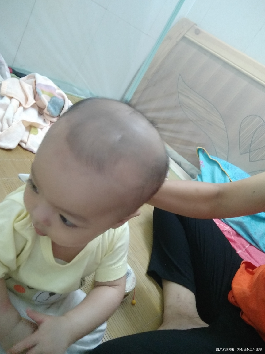 六个月宝宝脑囱怎么鼓起来的