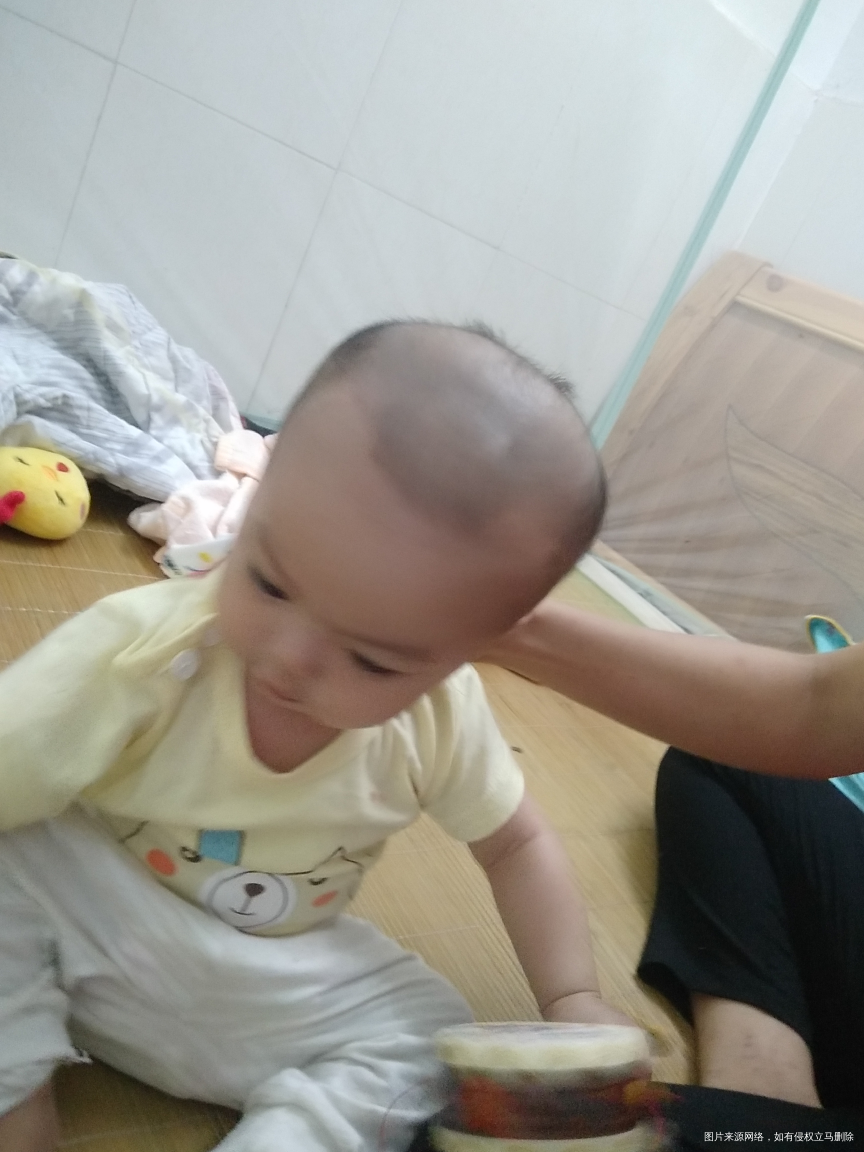 六个月宝宝脑囱怎么鼓起来的