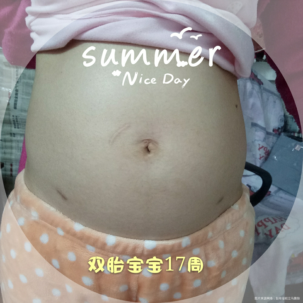 【试管感悟】双胎宝宝17周了