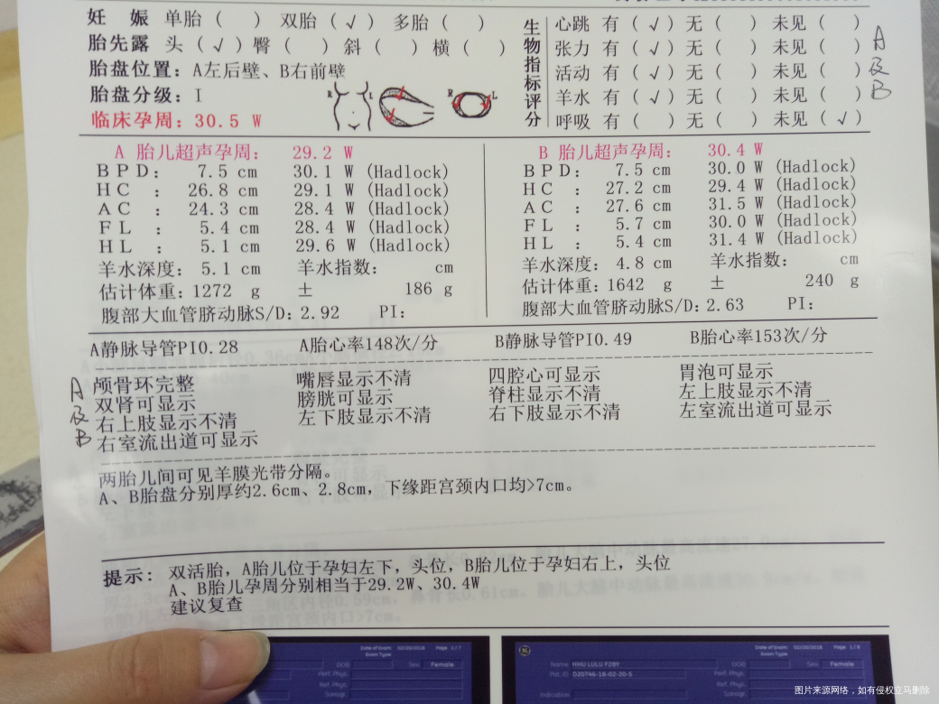 有一个宝宝偏小一周,好像体重偏轻