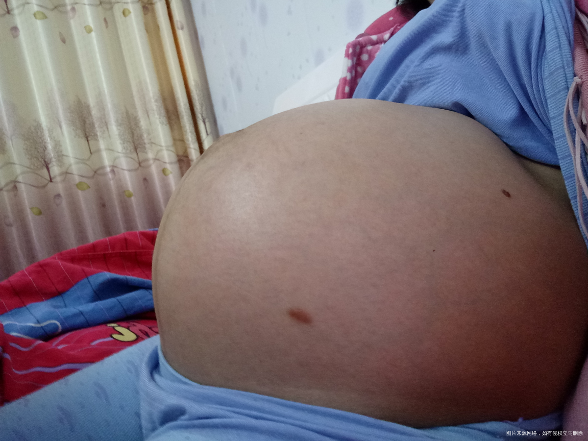 31周的肚子,有青筋是不是要长纹了
