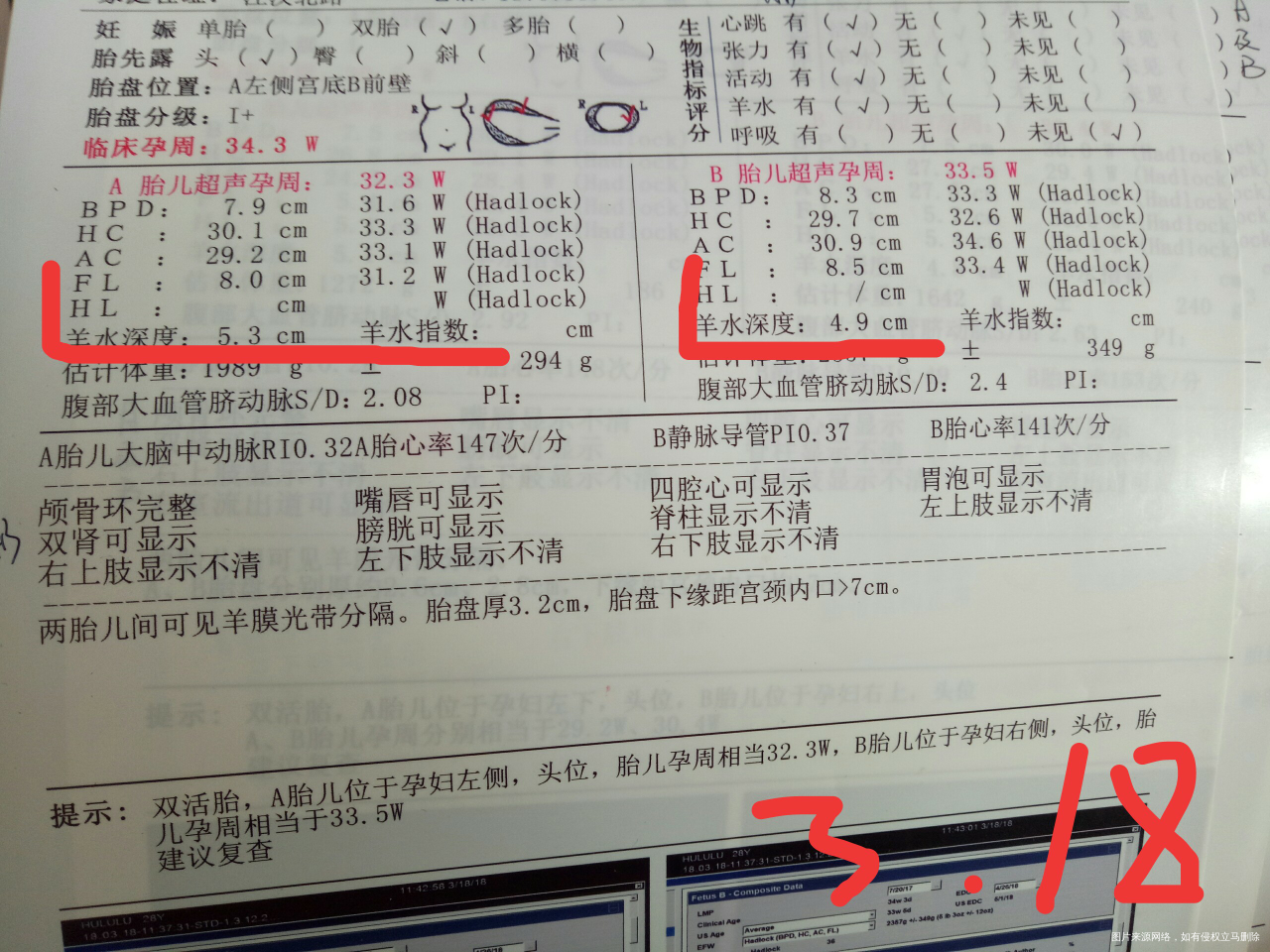 姐妹们帮忙看看孕晚期BC单