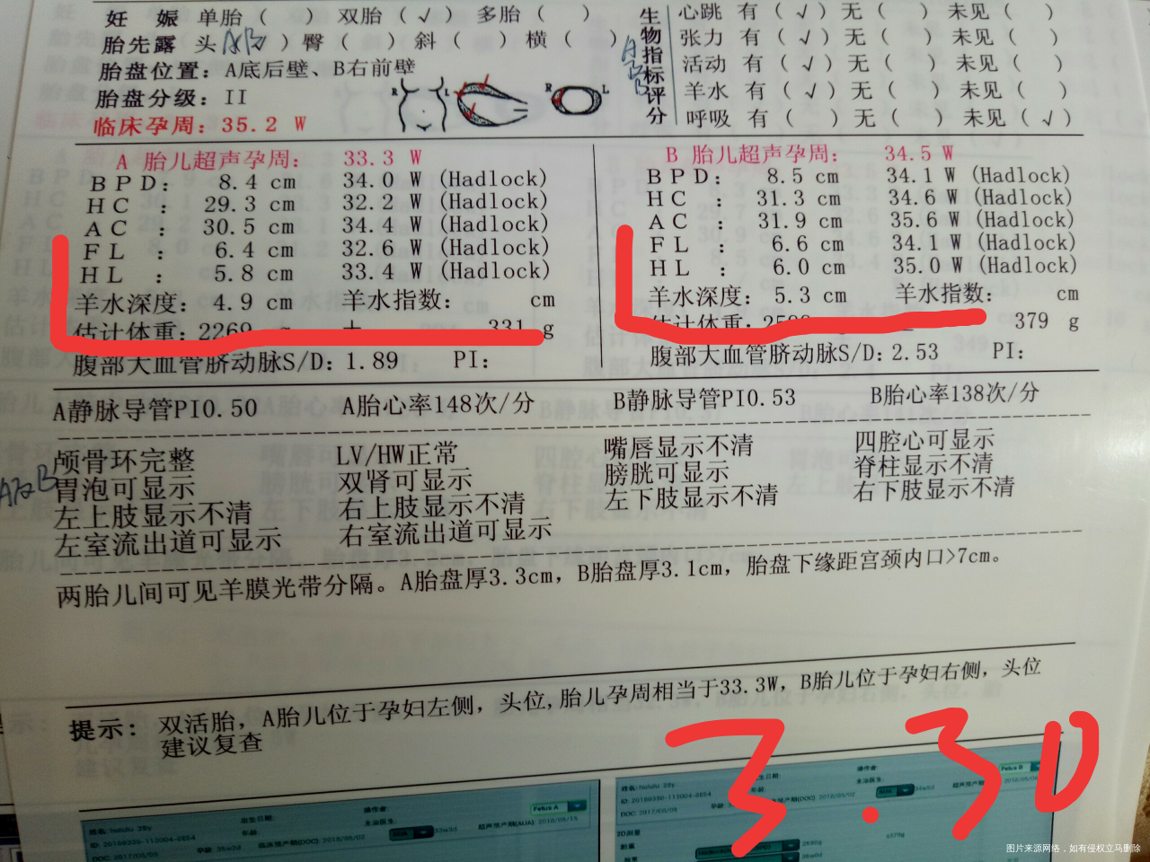 姐妹们帮忙看看孕晚期BC单