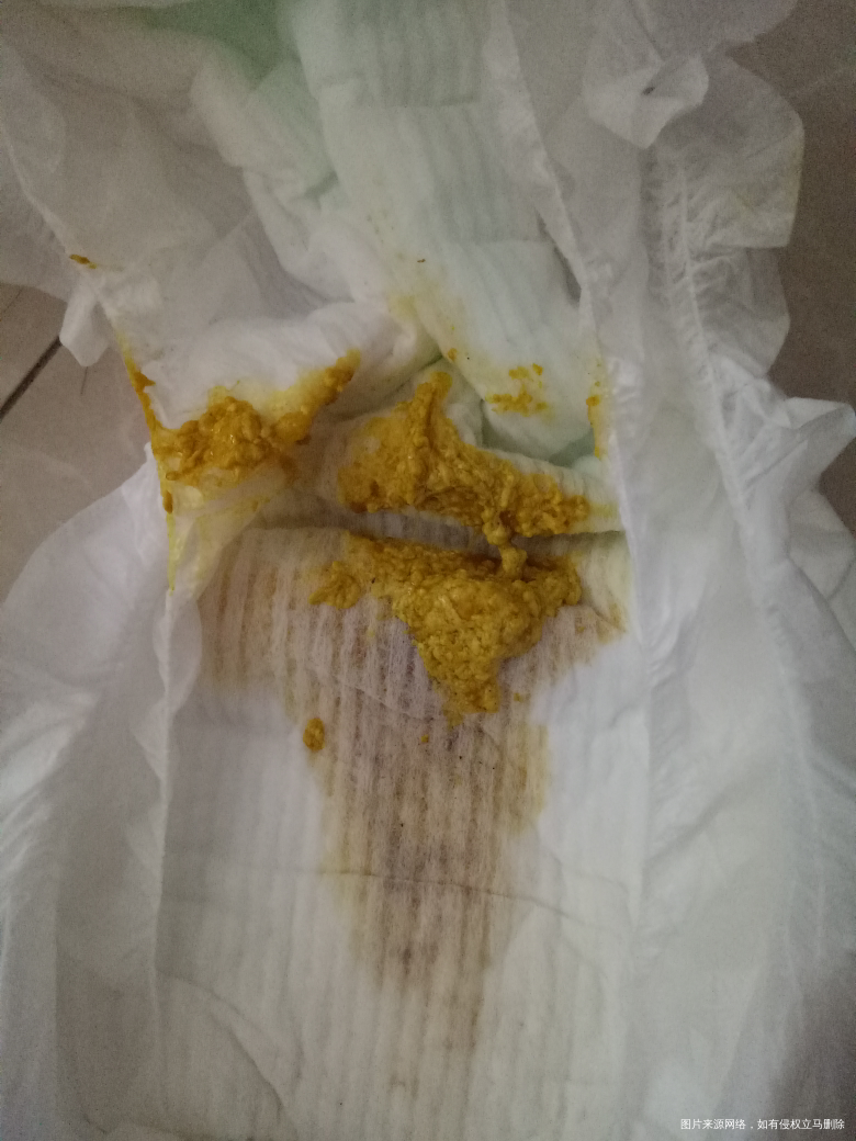 麻烦医生看看这是消化不良还是拉肚子