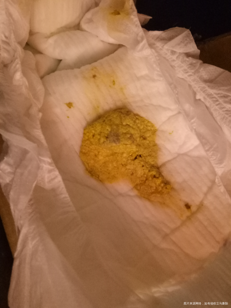 宝宝拉肚子停母乳后大便很干