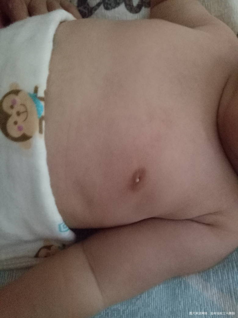 女宝宝这胸上有白点是怎么回事