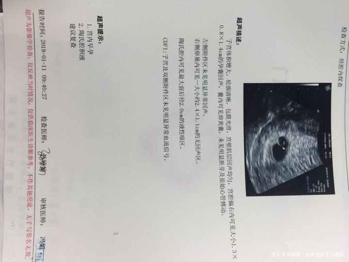 孕38天，孕囊离宫腔右边只有5.5毫米