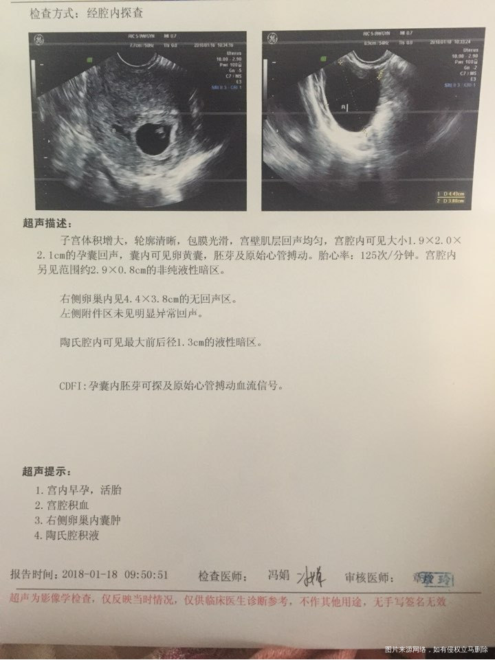 宝妈们,问一下你们小宝宝孕6周到8周的心跳每分钟多少