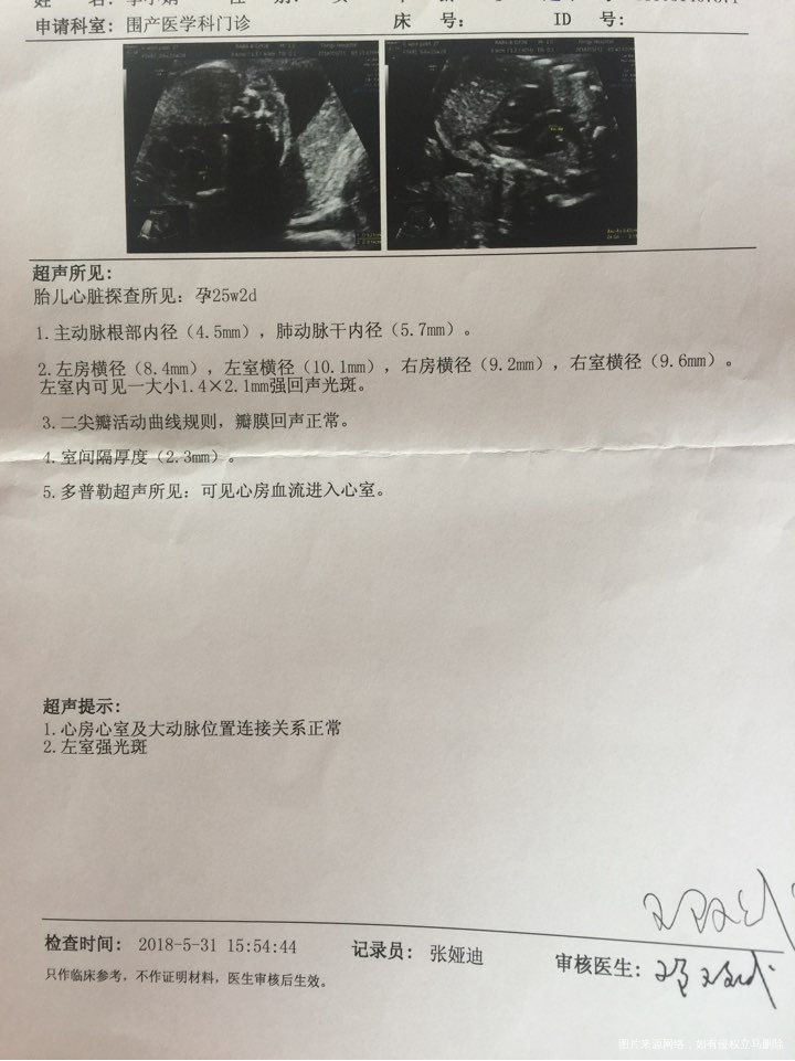 三维半个月后查胎儿心脏B超