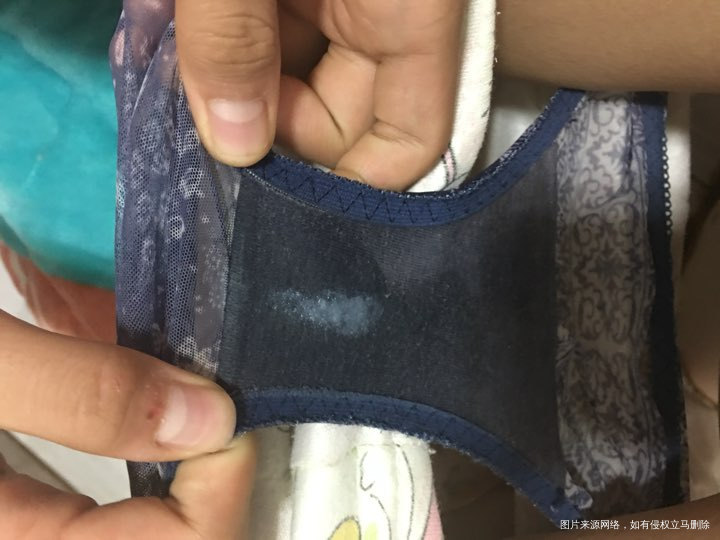 急急急急,求医生帮忙看一下什么情况??