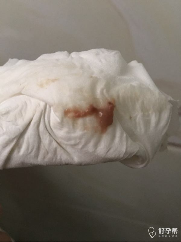 刚刚上洗手间流了点这个,肚子不痛,也没破水,今天已经411了