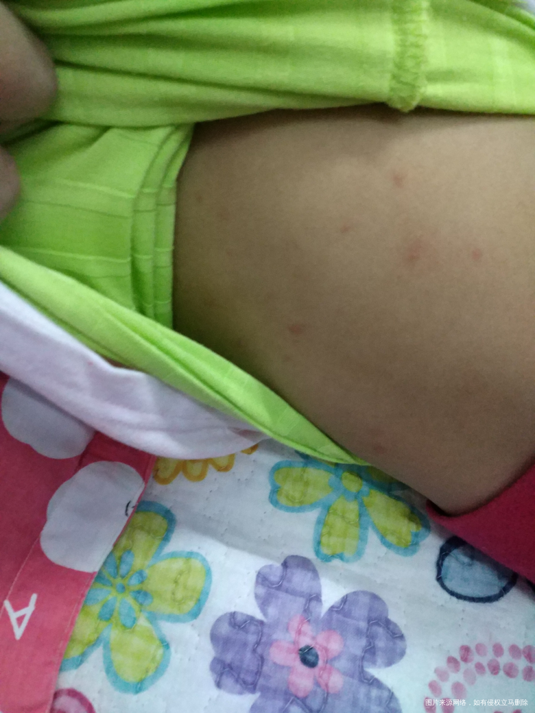 紧急求助 麻烦医生帮忙看看