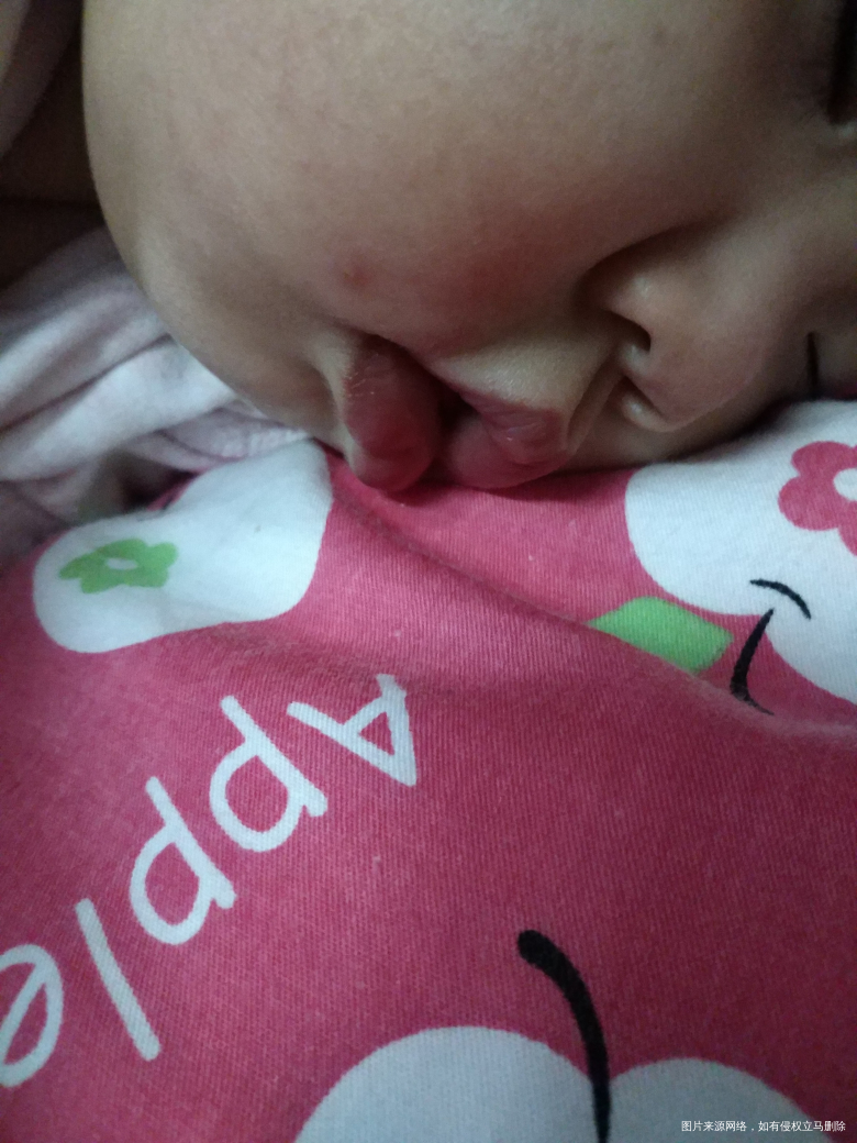 紧急求助 麻烦医生帮忙看看