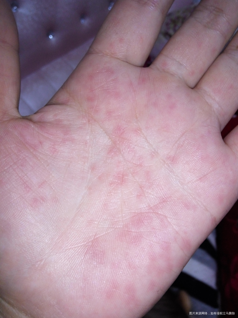 我的手不知道怎么了!像针扎似的疼啊!