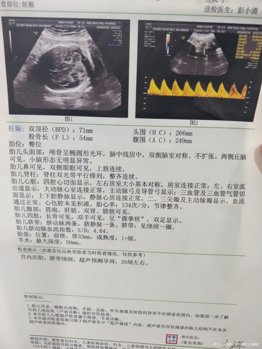 29周+2,今天做了第二次四维