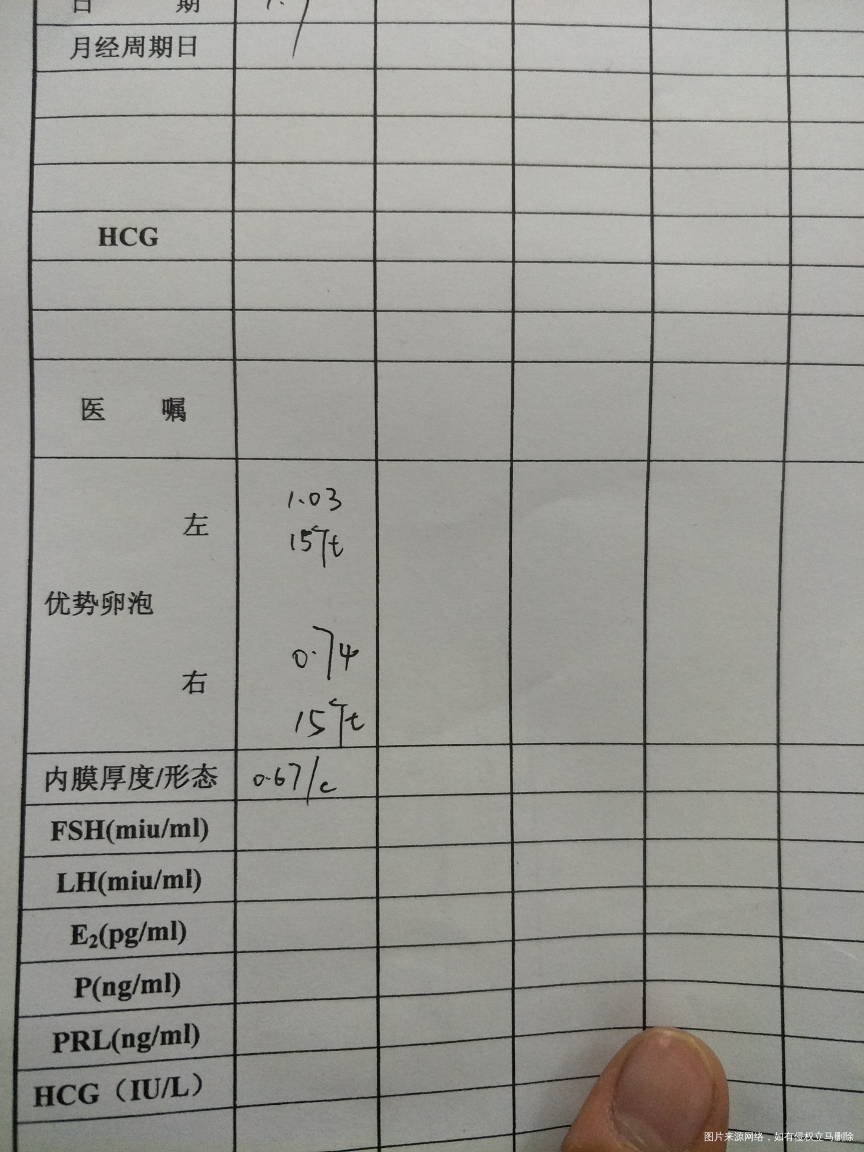 多囊卵巢综合症,激素各项都正常