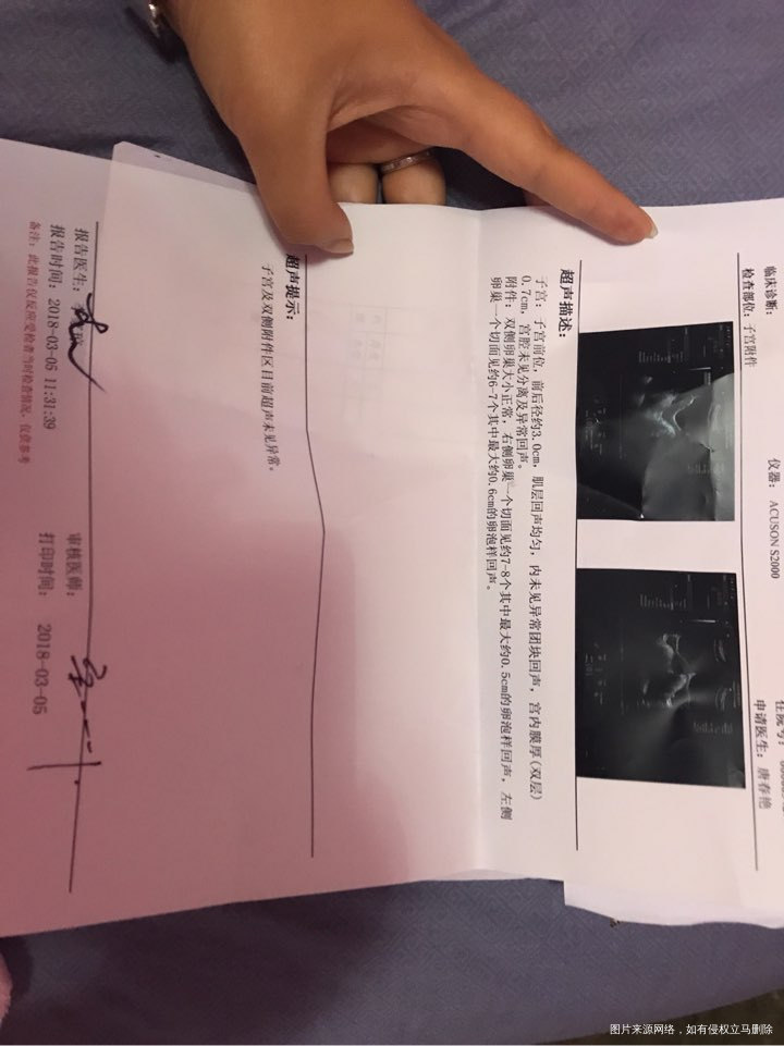 请医生帮忙看看这可疑的排卵期