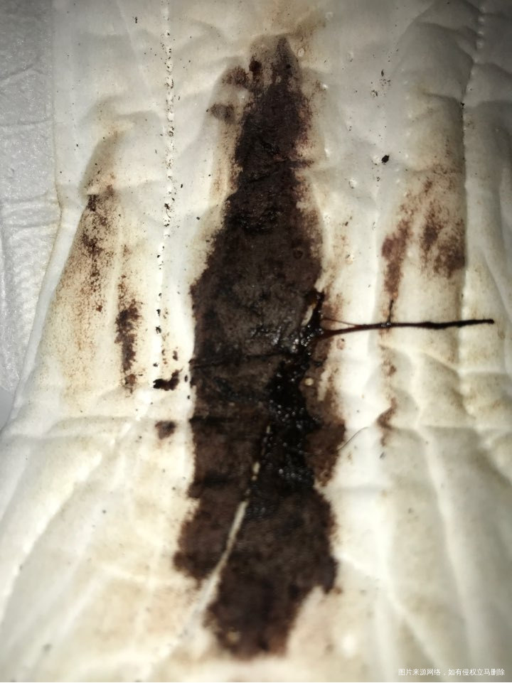 月经周期颜色量都不正常