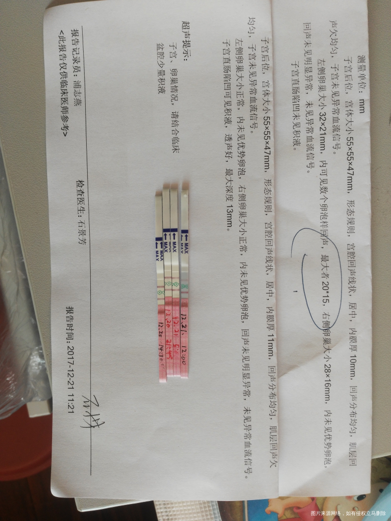 这样可以推断出什么时间排卵?