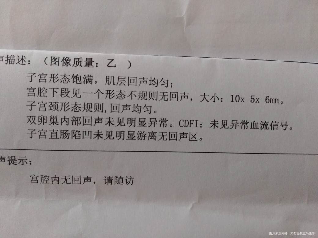 孕5周加4,刚做的B超单