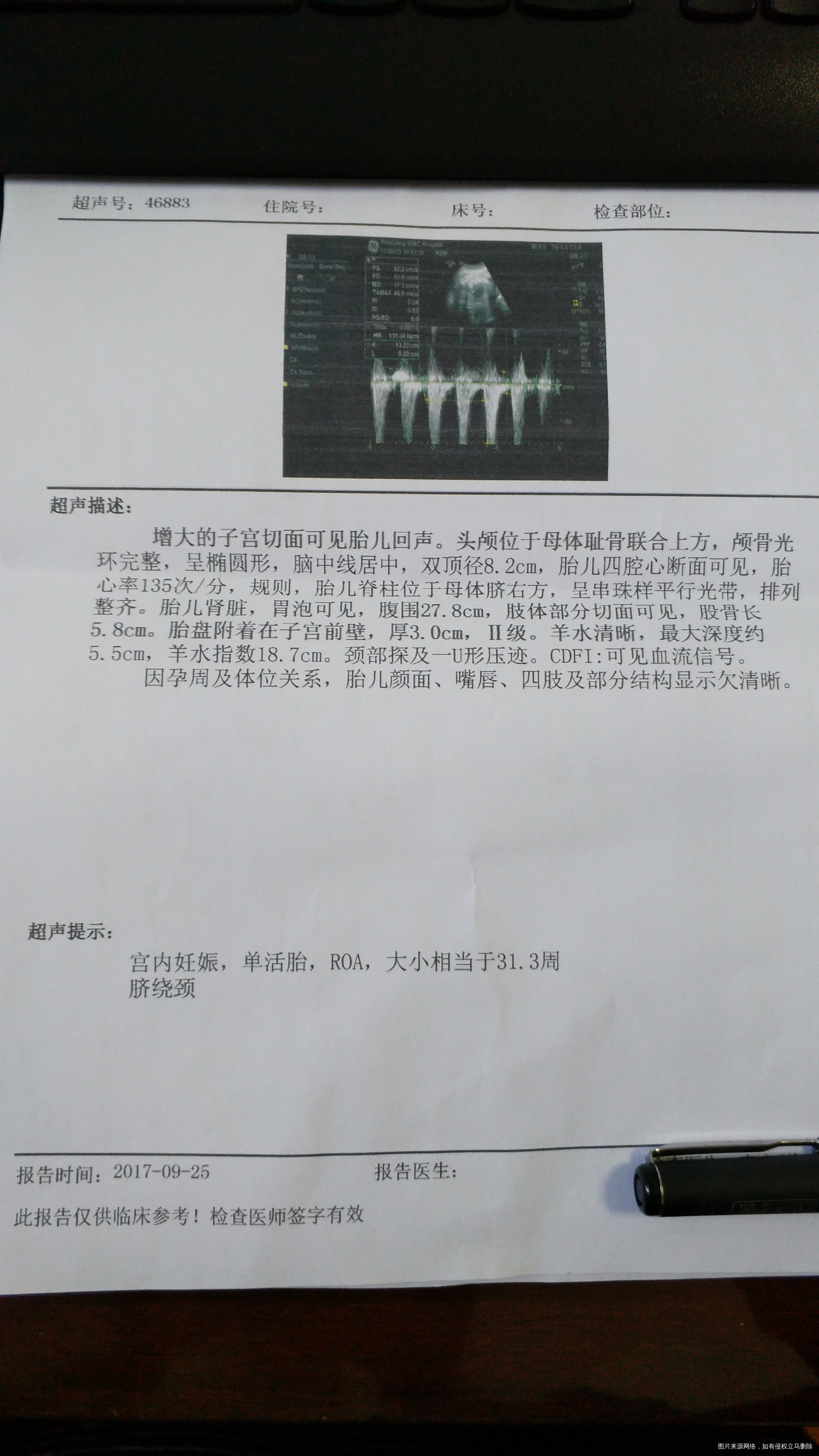 请在线医生看看,多谢了