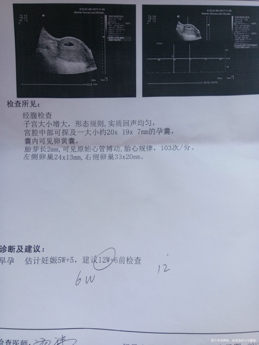 这样的检查单是不是就不会胎停了呢
