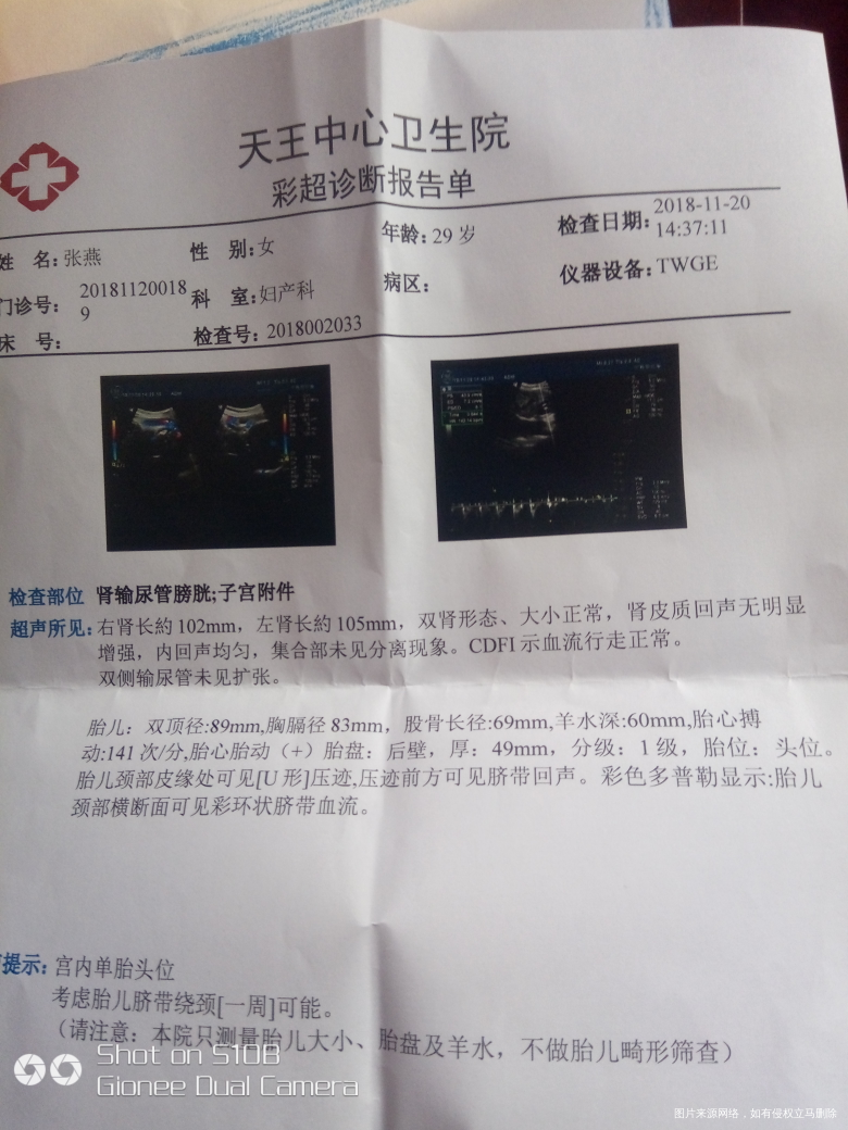 麻烦医生过来看看谢谢!!!