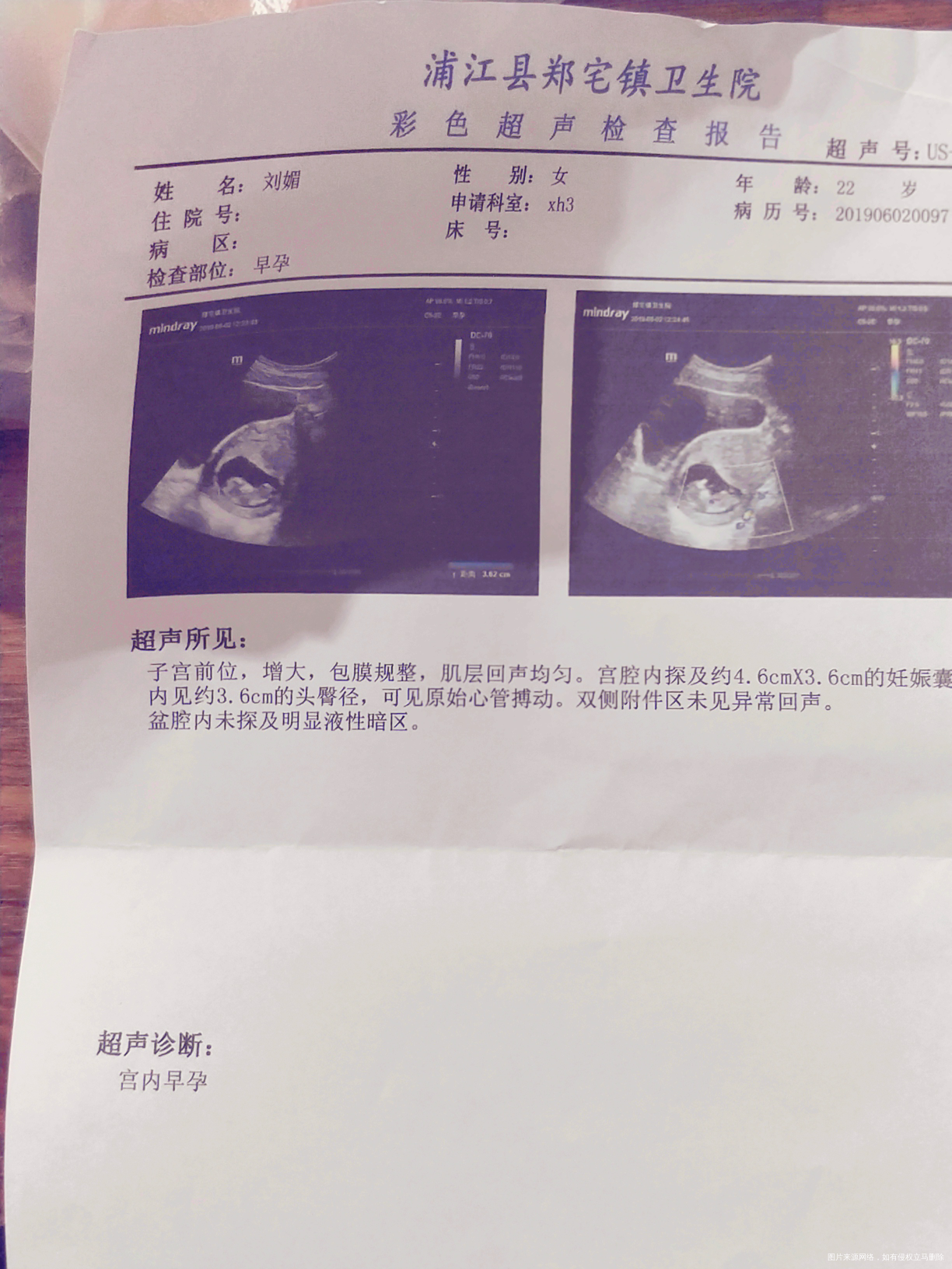 这个怎么看不懂,没有其它东西啊![/st