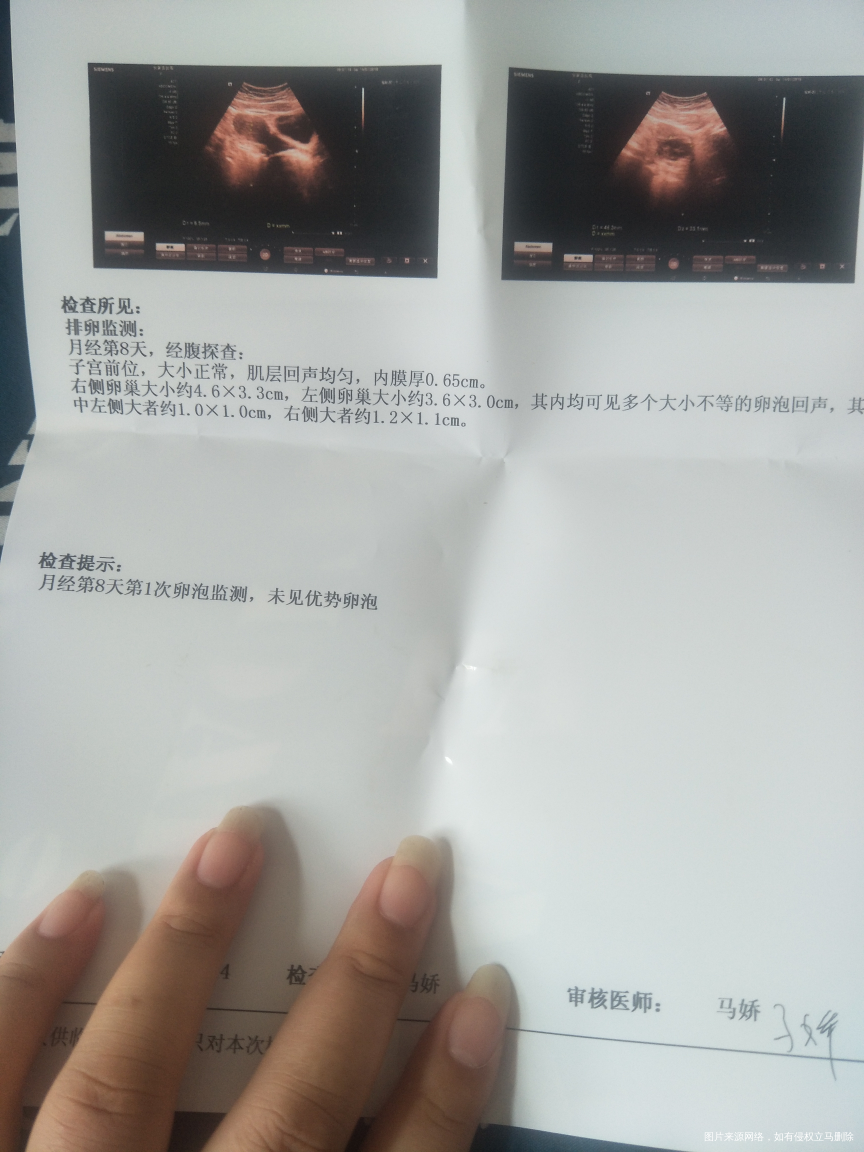 求助医生一下,帮我进来看看吧!