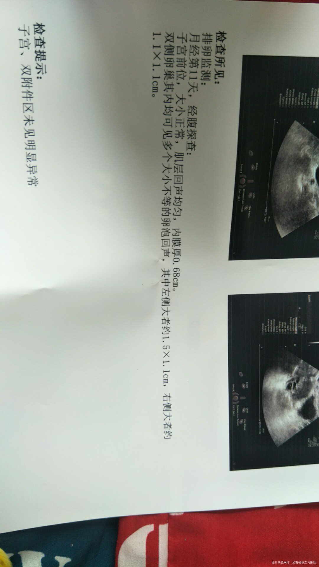 医生进来帮我分析一下呗!在线等!