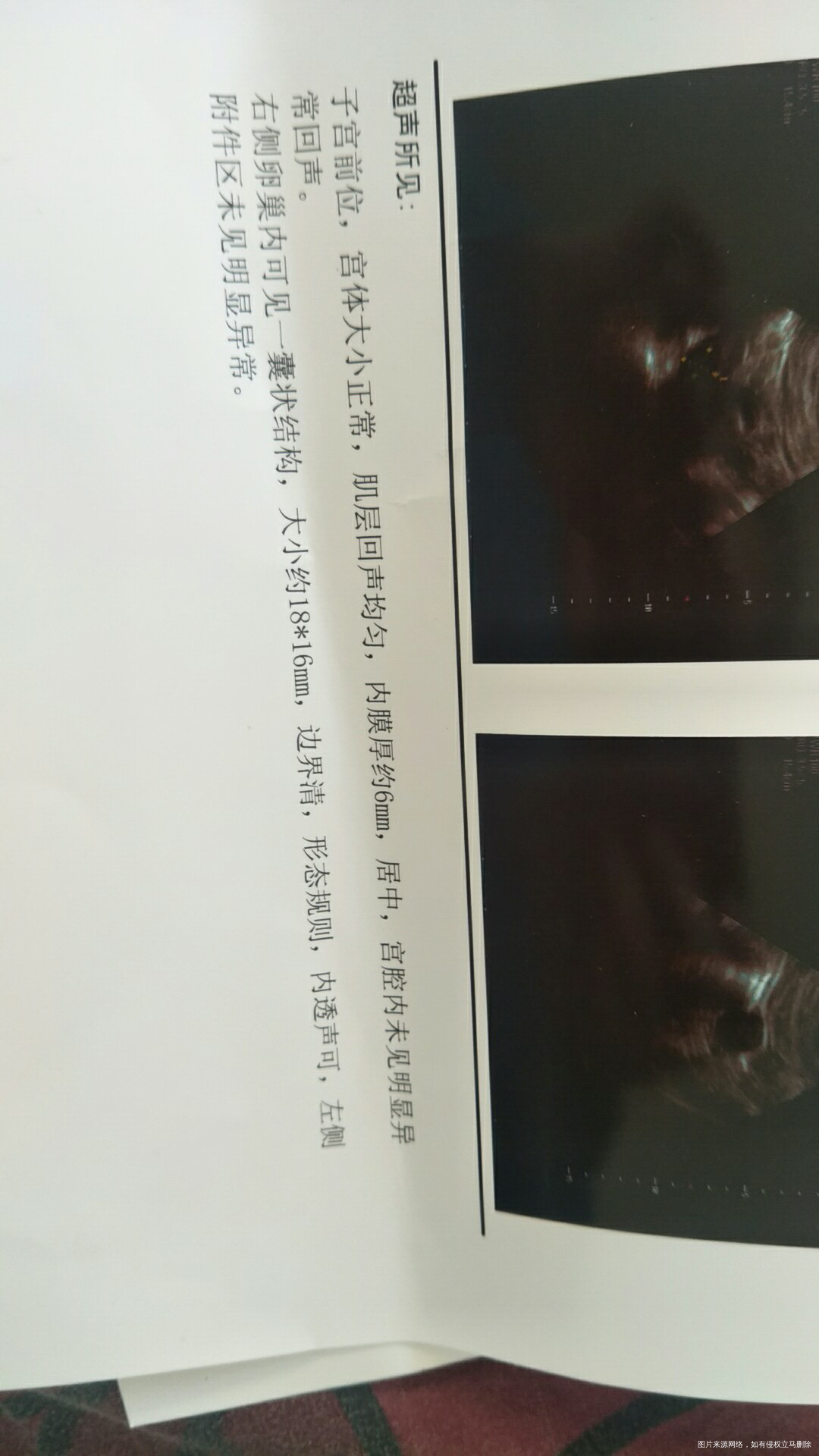 医生在线解答一下好吗?在线等……