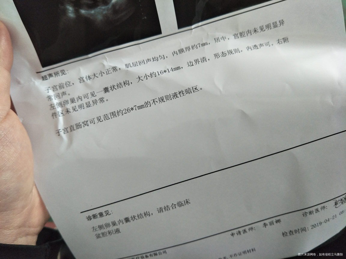 医生你好,请帮我看一下B超单子!谢谢