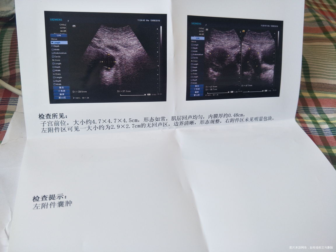 医生,在线解答一下,3号到9号月经期结束第三天又来了!