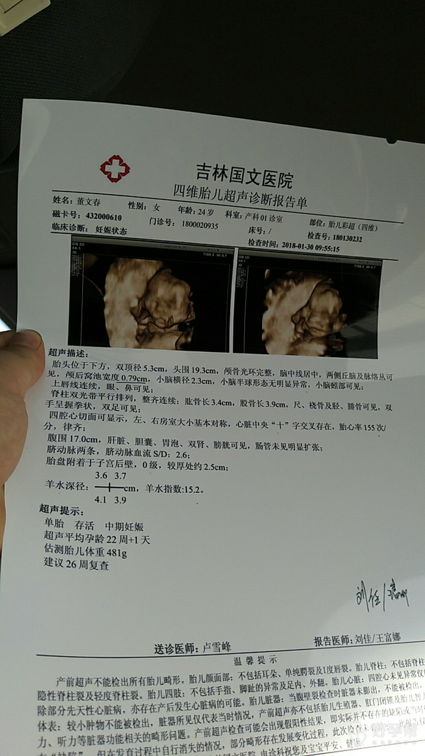 22周做的四维,想知道男孩女孩