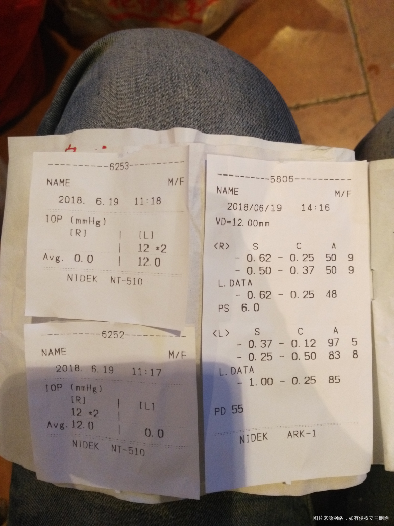 麻烦医生帮忙看看,孩子近视了?