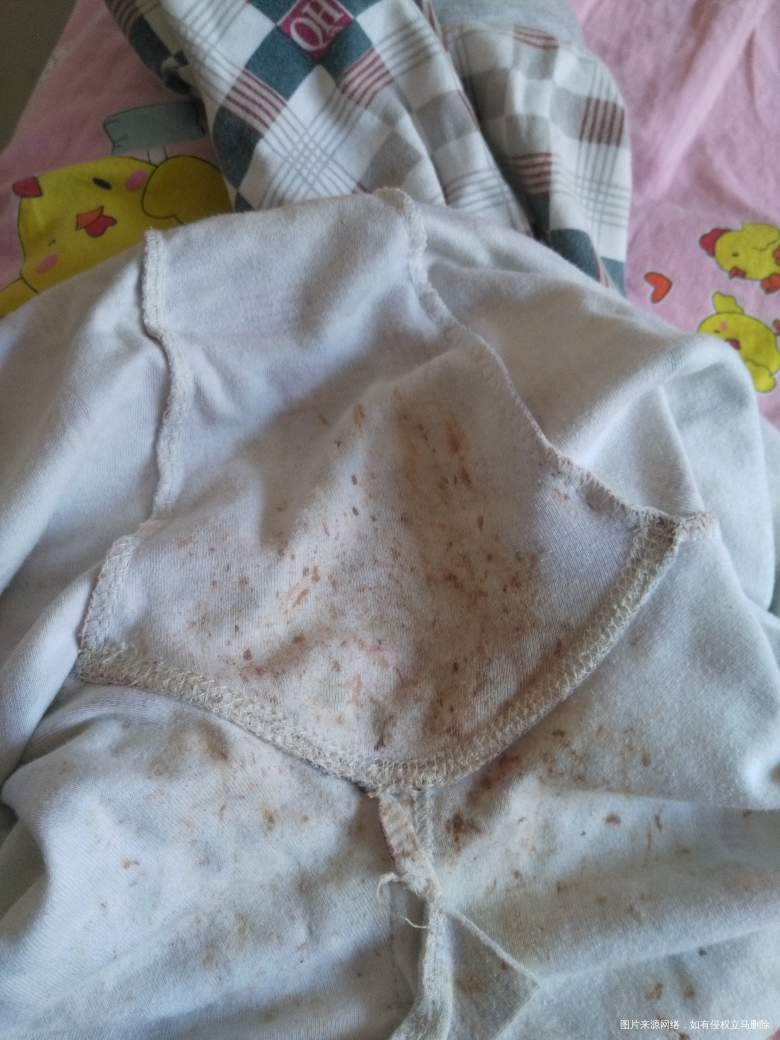 2019-01-23
大宝的线裤全是血,小鸡起湿疹挠破皮了,在…