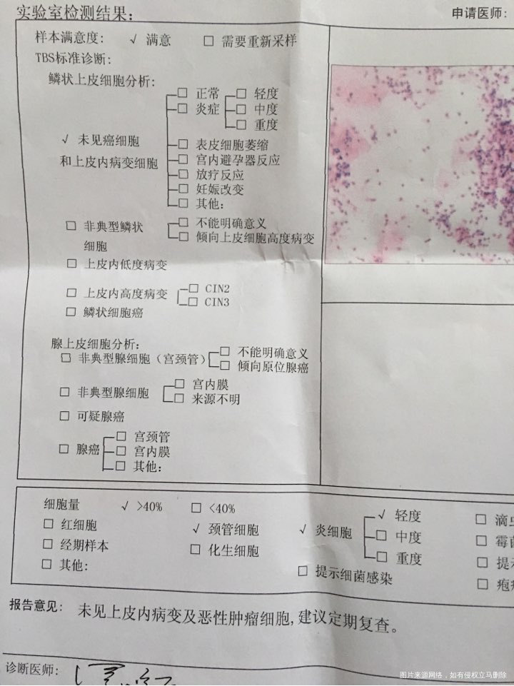 请医生帮忙看看 阴道炎和宫颈糜烂严重吗?影响备孕吗?