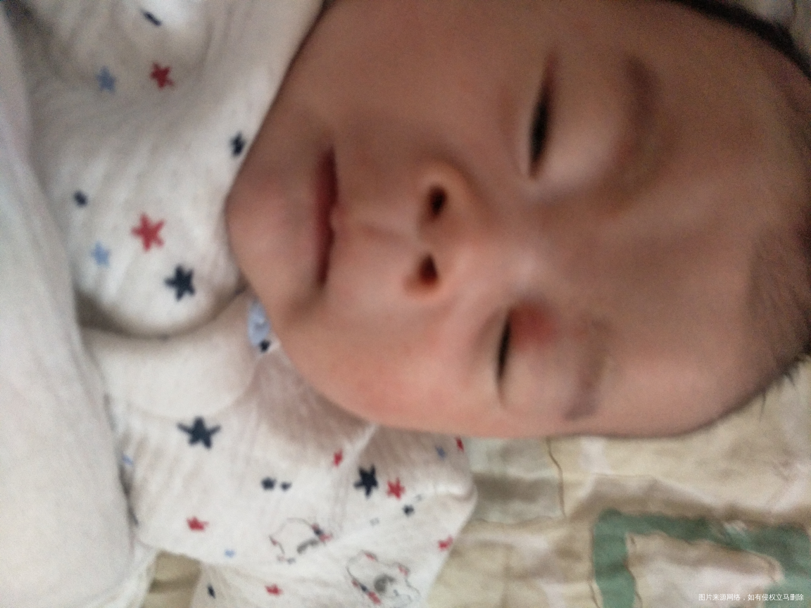 看看宝宝眼皮上很红,怎么回事,