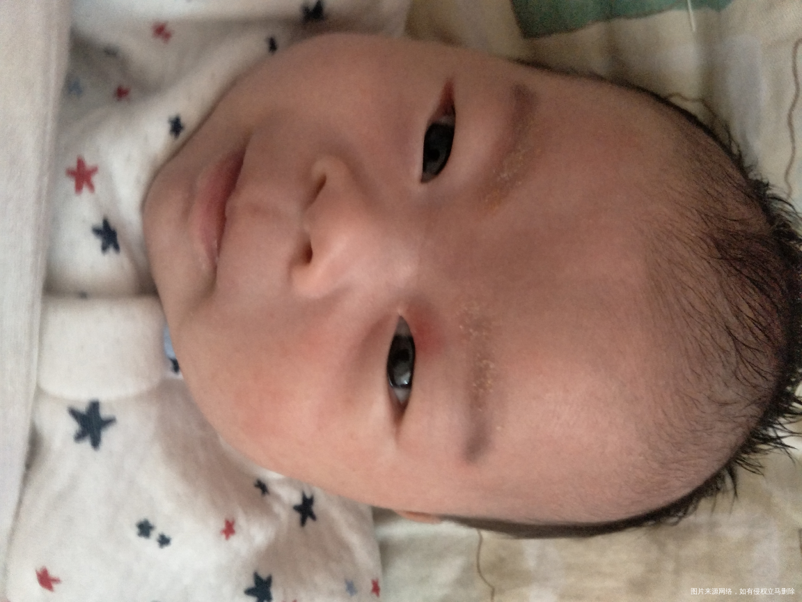 看看宝宝眼皮上很红,怎么回事,