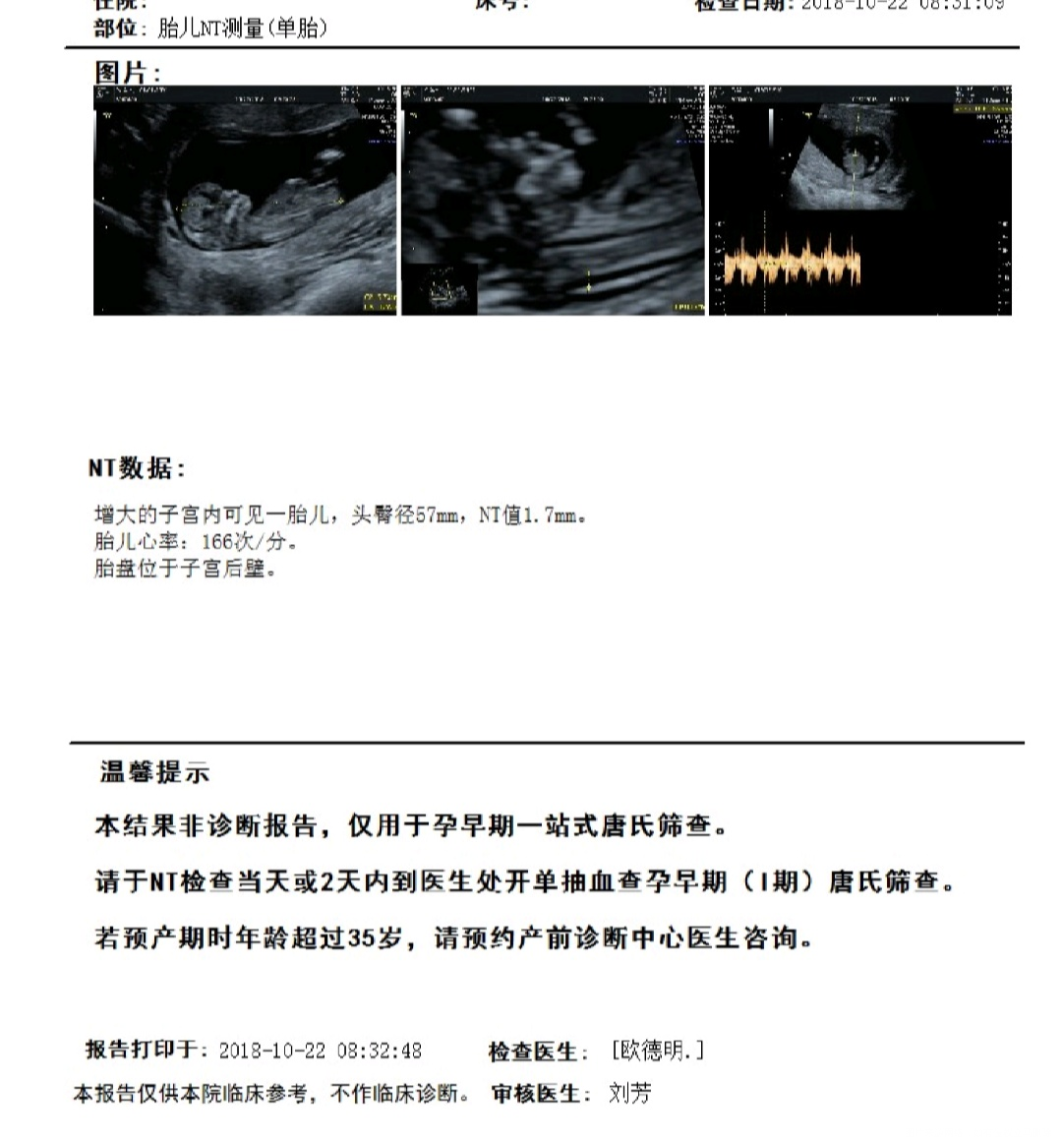 请医生帮忙看看NT结果