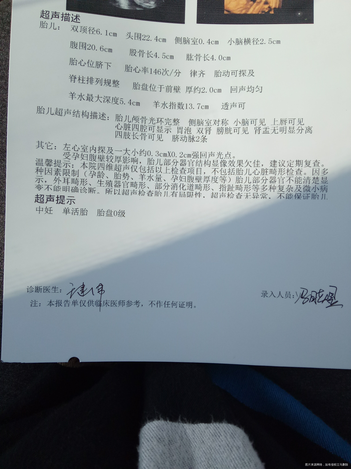 四维结果医生帮忙看看