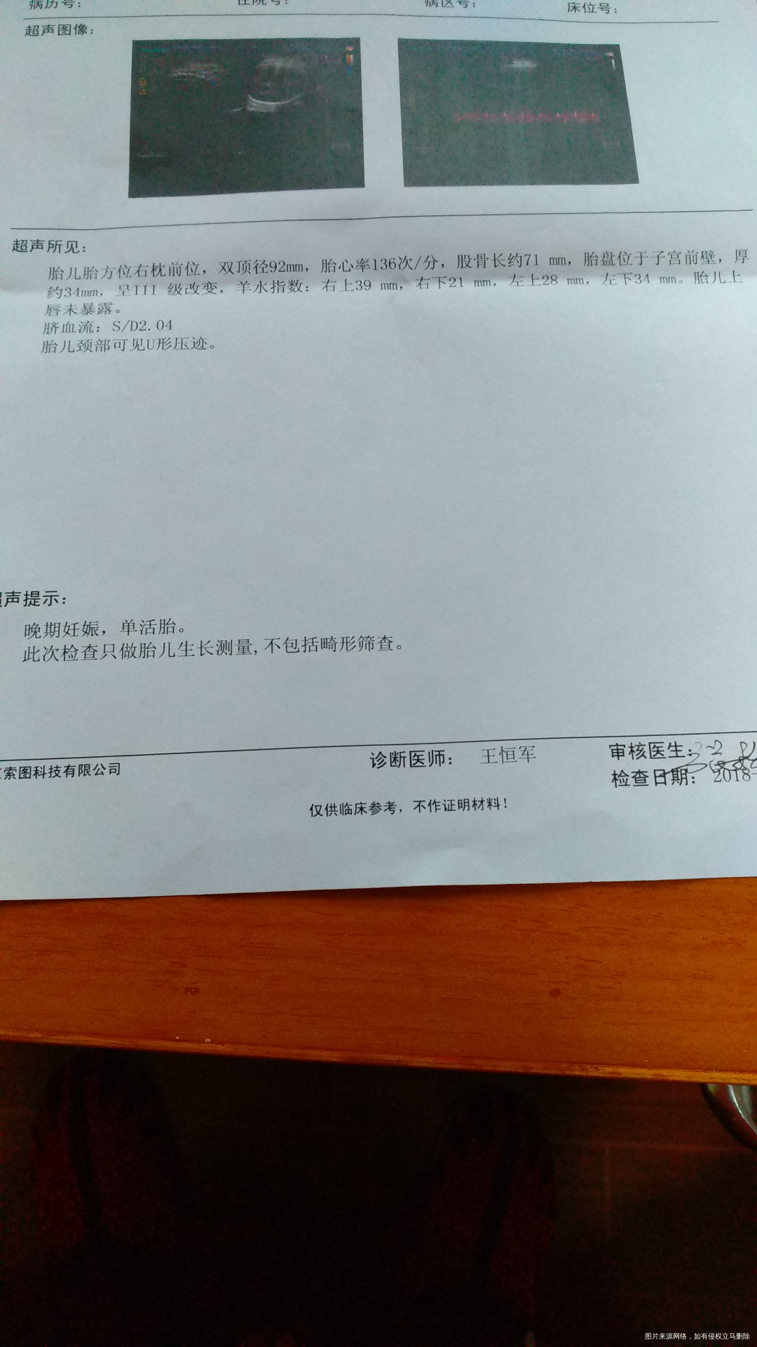 预产期已经41周加胎盘三级,需要提前住院吗?