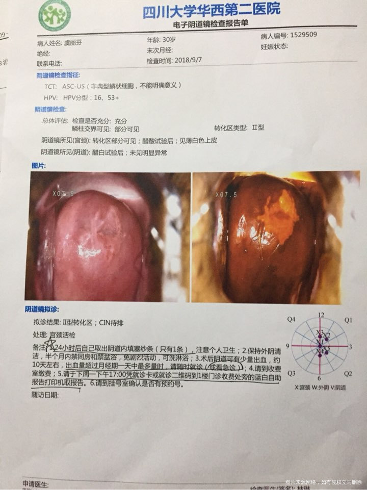 这报告可以做试管吗?急需求教