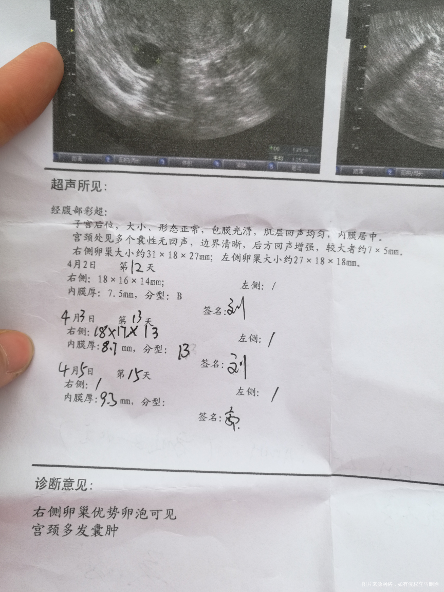 怎样安排同房,怀孕几率高。