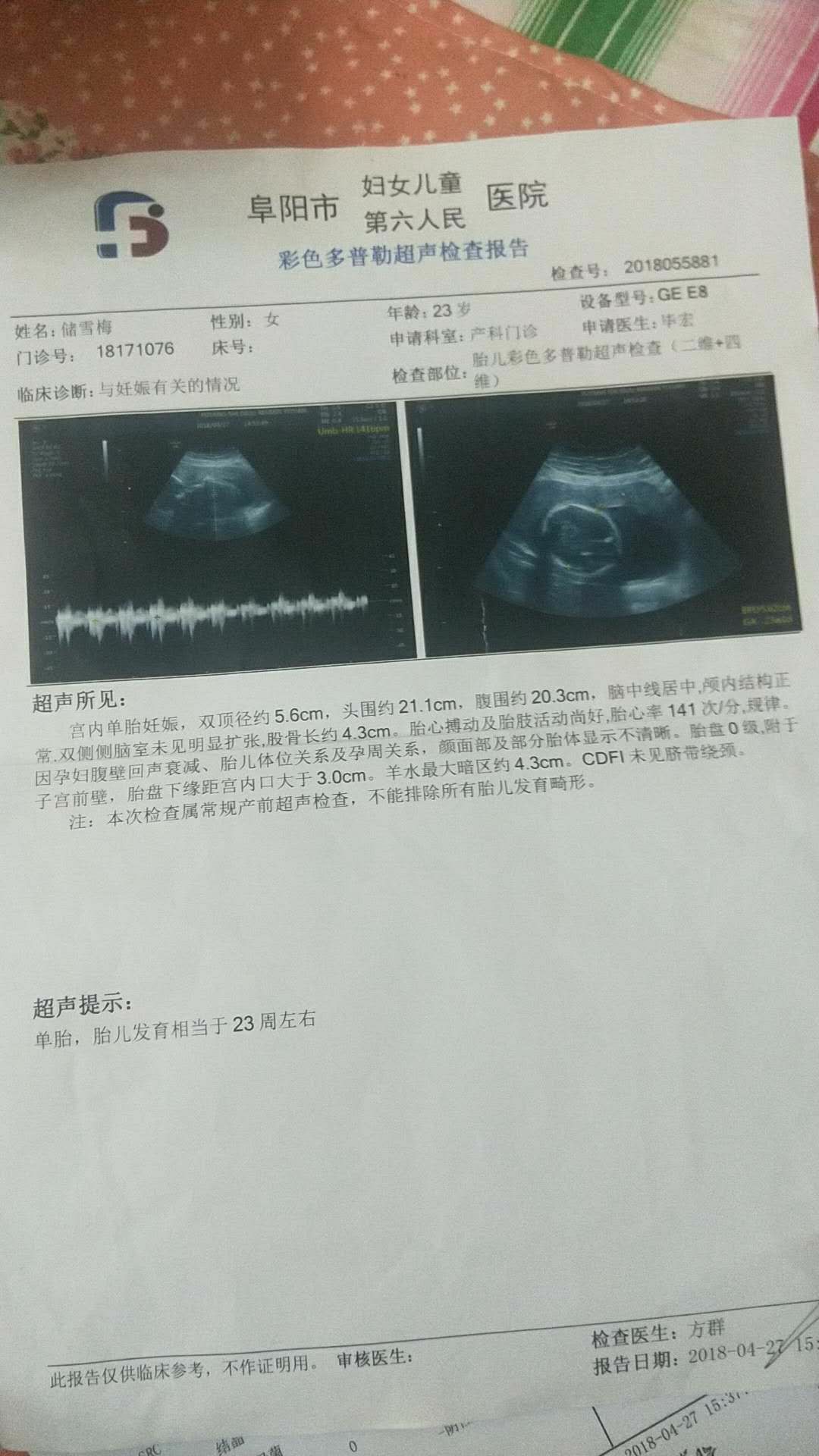 孕24周 胎盘还是没上去 走多了肚子疼